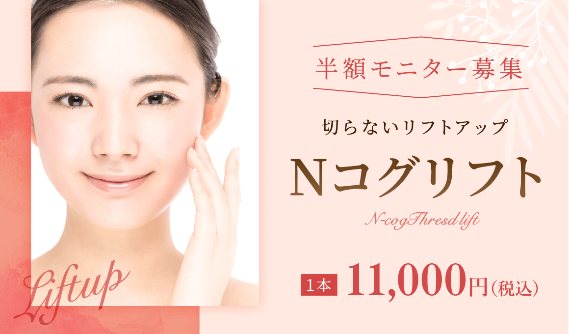 Nコグリフト