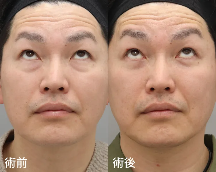 正面