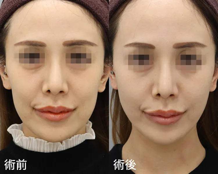 症例写真正面