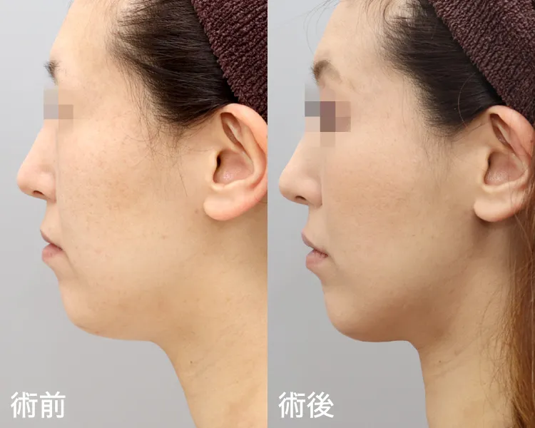 症例写真横