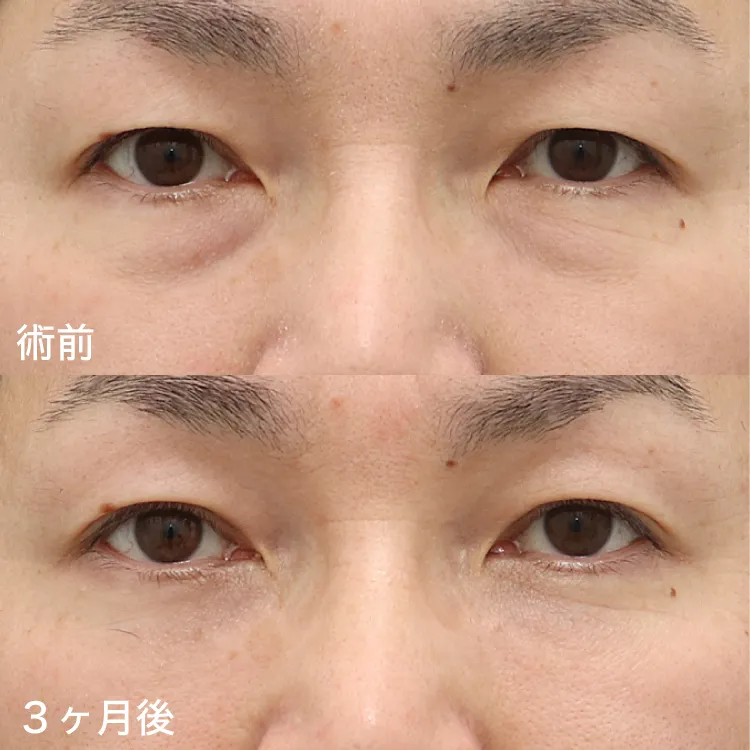 case01