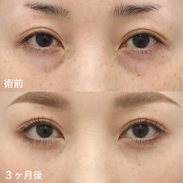 case02