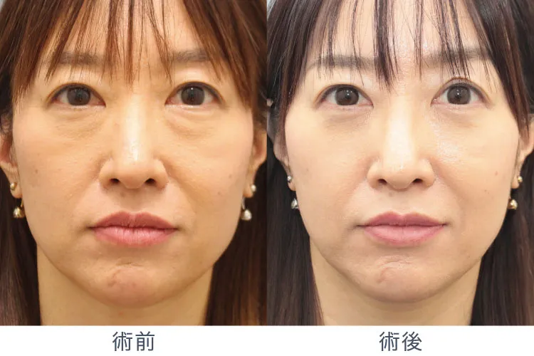 森院長施術症例写真