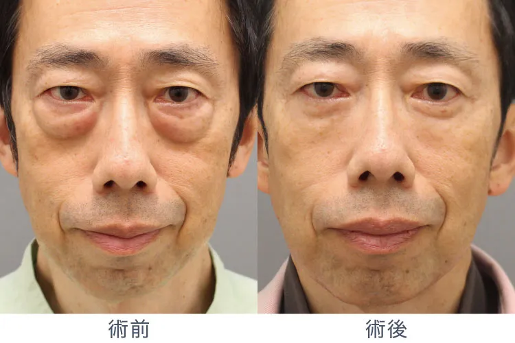 森院長施術症例写真