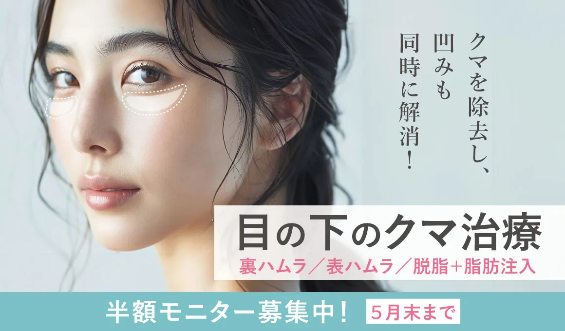 目の下のクマ治療半額モニター募集中