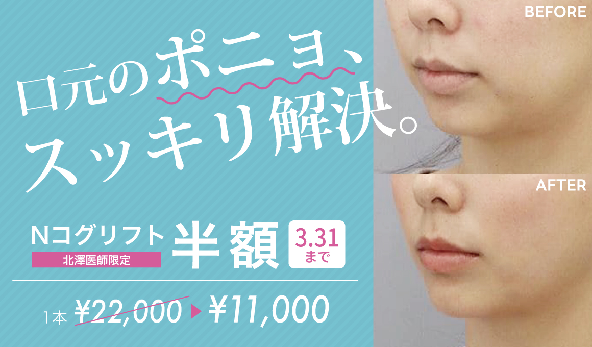 Nコグリフト
