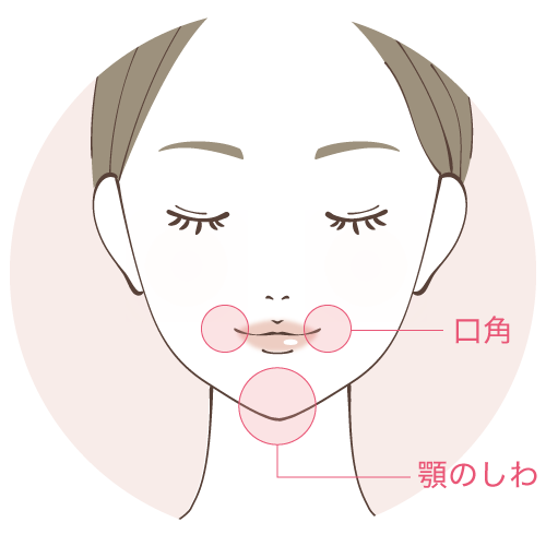 あごのコンビネーション治療