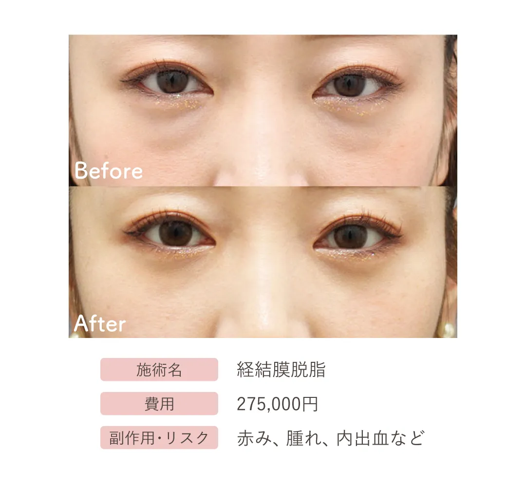 症例写真